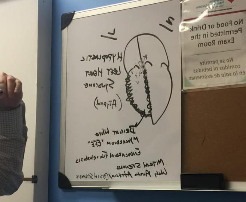 The drawing the pediatric cardiologist sketched on a dry erase board to explain hypoplastic left heart syndrome. (Photo courtesy of Stephanie Lewis)